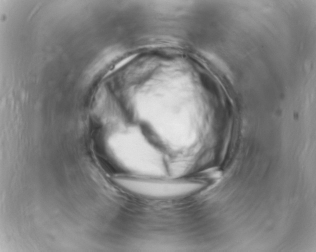 X0000088661407200706152021