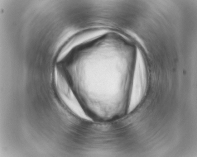 X0000088661415200706152021