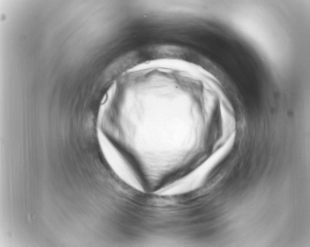 X0000088660765200706221635