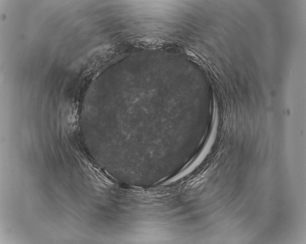 X0000088670818200705311140