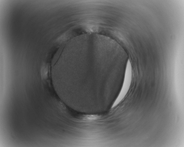 X0000088670233200706211857