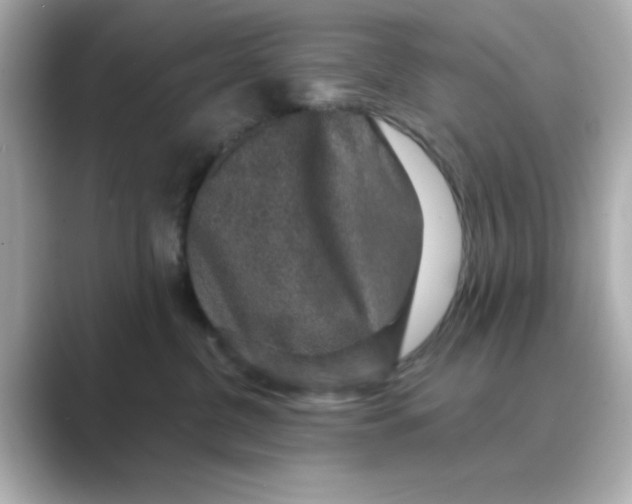 X0000088670380200706211855