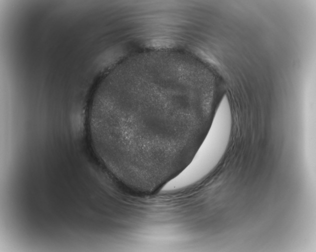 X0000088670735200706211850