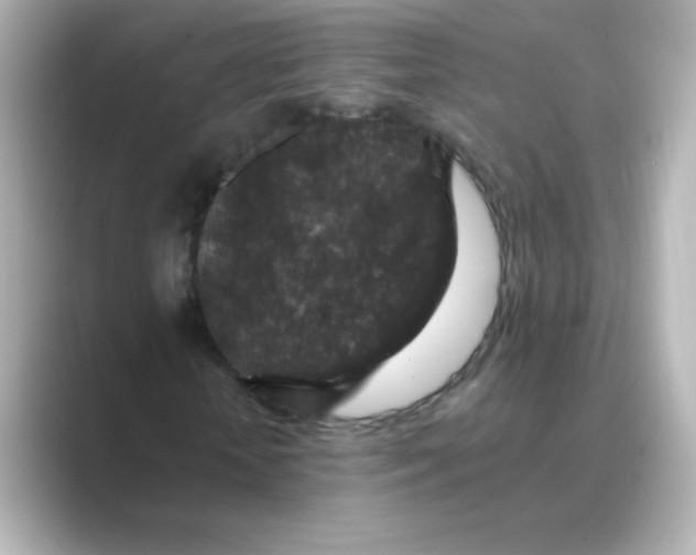 X0000088670818200706211849