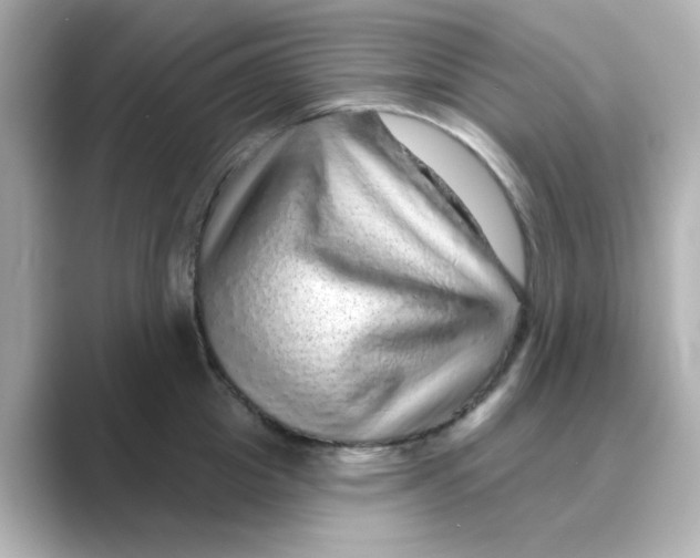 X0000088670857200706211849