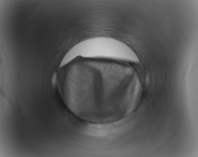 X0000088670041200706281931