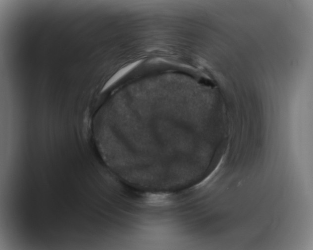 X0000088670192200706281929