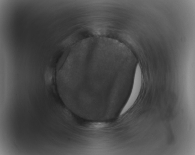 X0000088670233200706281928