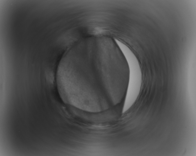 X0000088670380200706281926