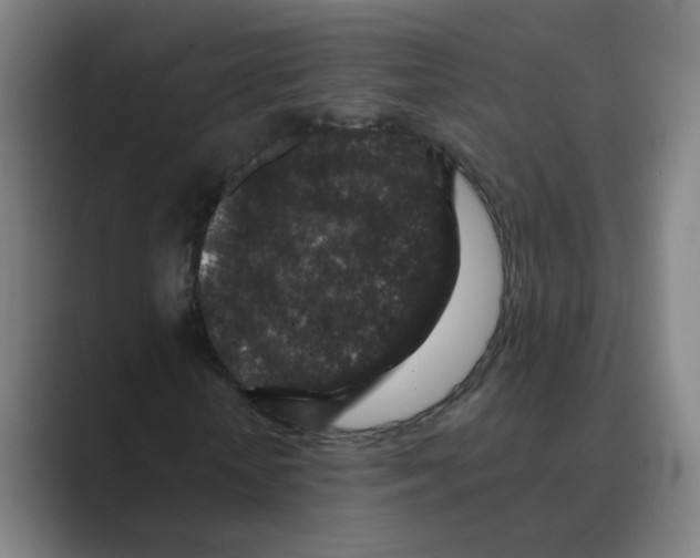 X0000088670818200706281920