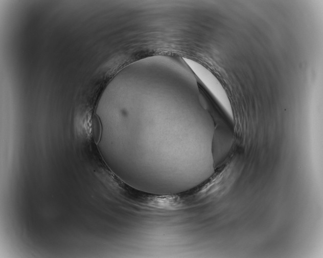 X0000088690479200705311200
