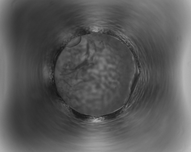 X0000088690569200705311159