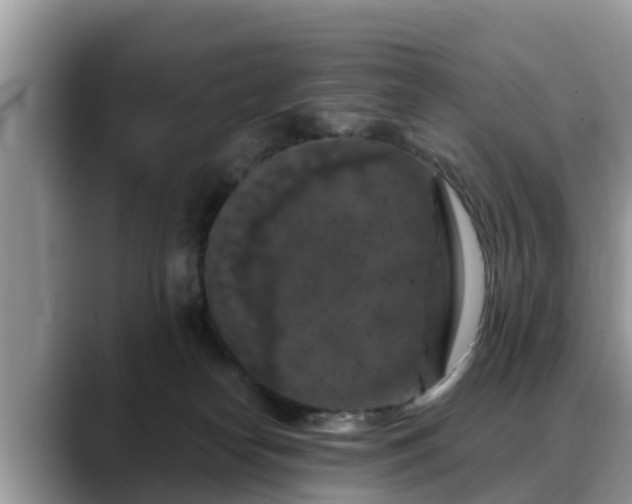 X0000088690182200706071527