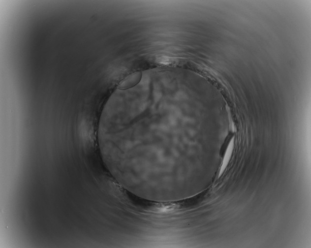 X0000088690569200706071522