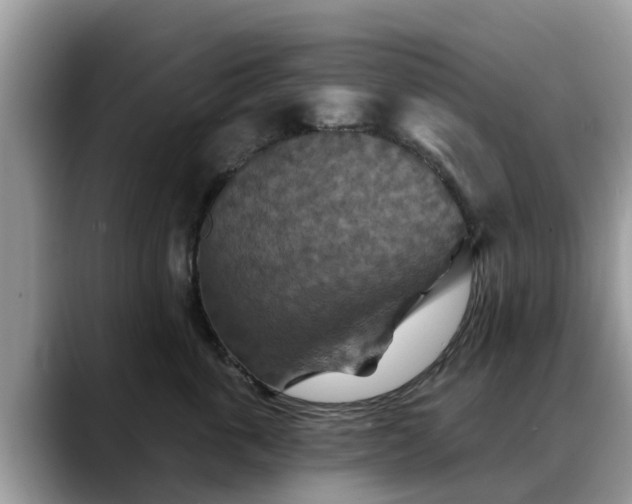 X0000088690763200706071519