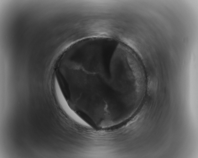 X0000088691455200706071510