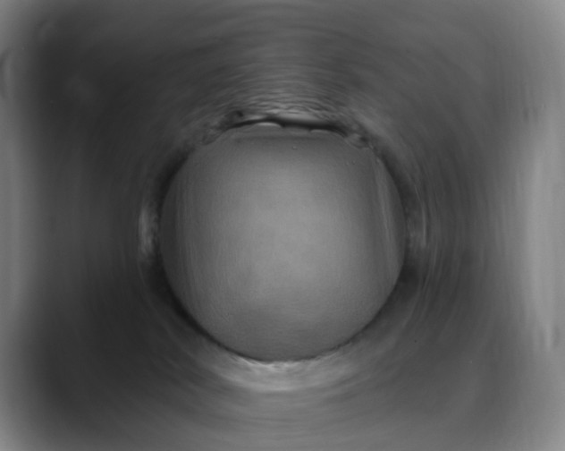 X0000088690038200706141420