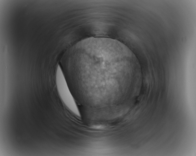 X0000088690084200706141420