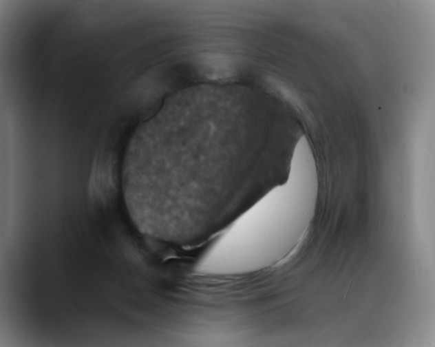 X0000088690170200706141418