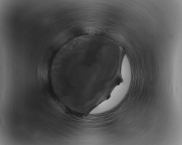 X0000088690266200706141417