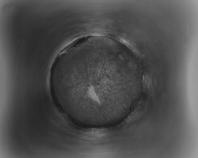 X0000088690292200706141417