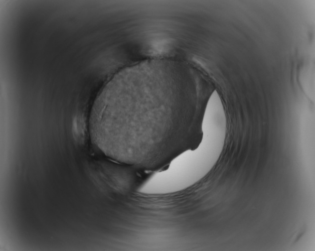 X0000088690380200706141416