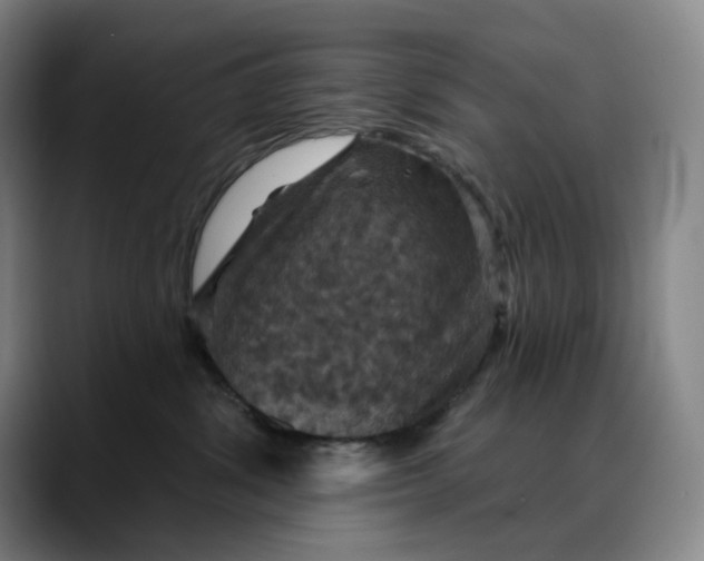 X0000088690428200706141415