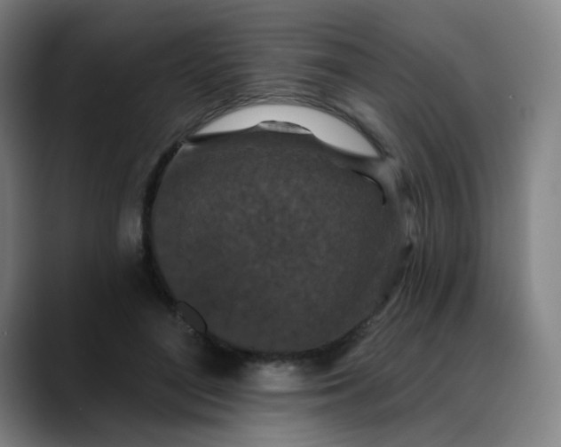 X0000088690500200706141415