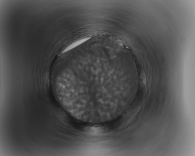 X0000088690506200706141415