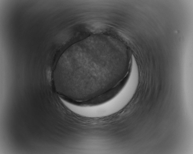 X0000088691108200706141407