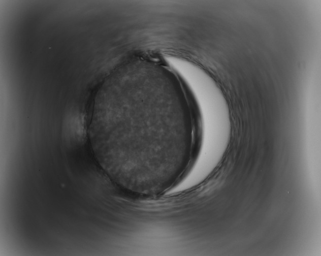 X0000088691156200706141407