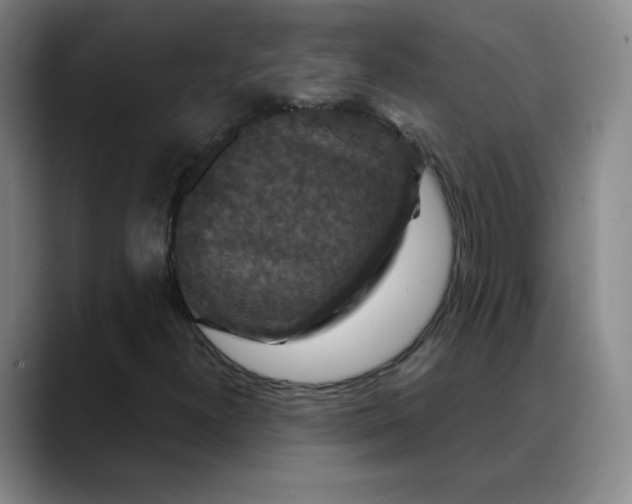 X0000088691300200706141405