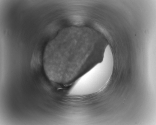 X0000088690170200706211933