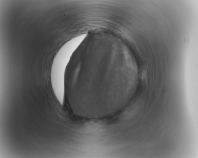 X0000088690868200706211925