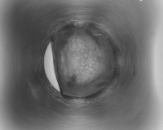 X0000088690914200706211924