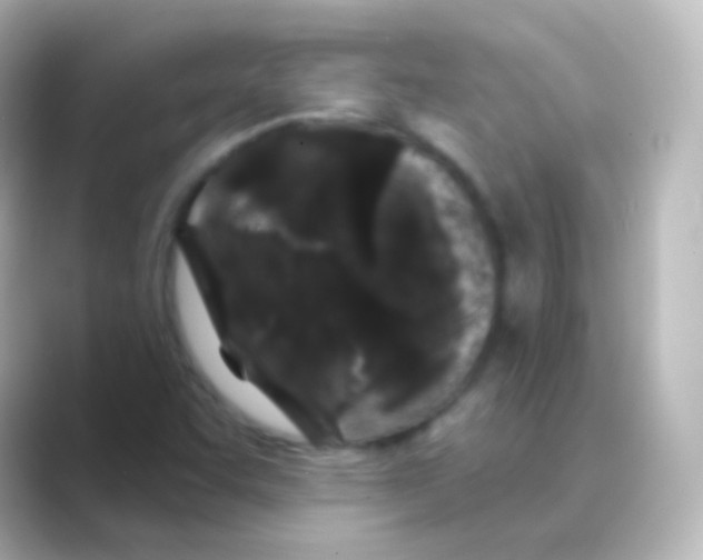 X0000088691455200706211918