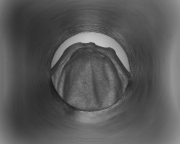 X0000088690045200706282011