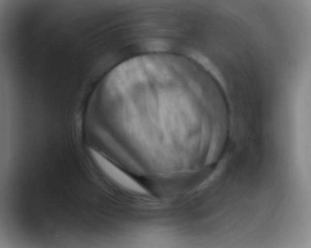 X0000088690057200706282011