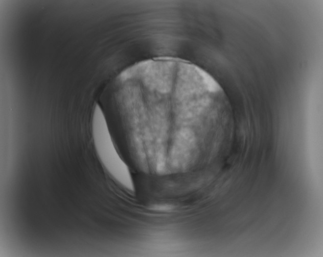 X0000088690084200706282011