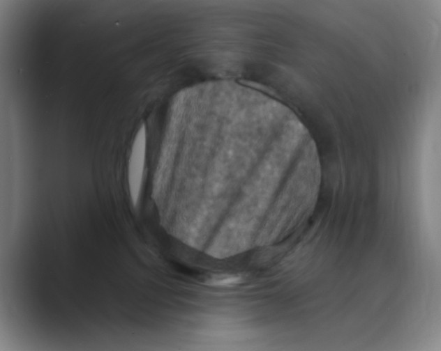 X0000088690088200706282011