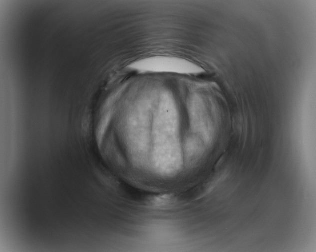 X0000088690092200706282011