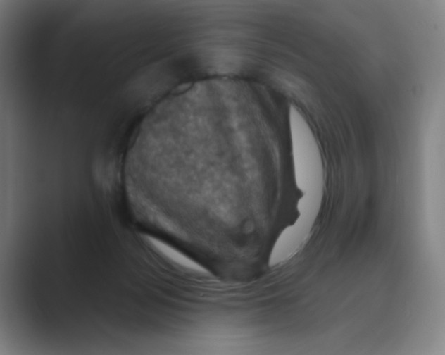 X0000088690172200706282010