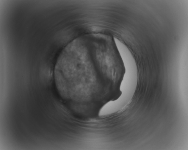 X0000088690176200706282010