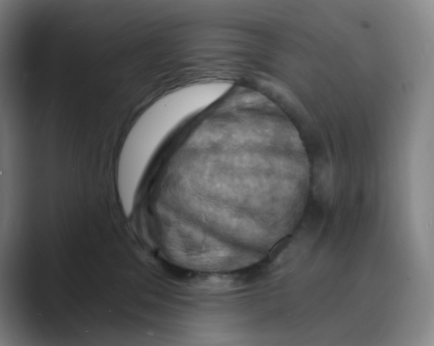 X0000088690329200706282007