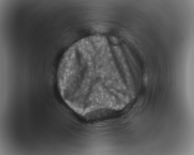 X0000088690464200706282006