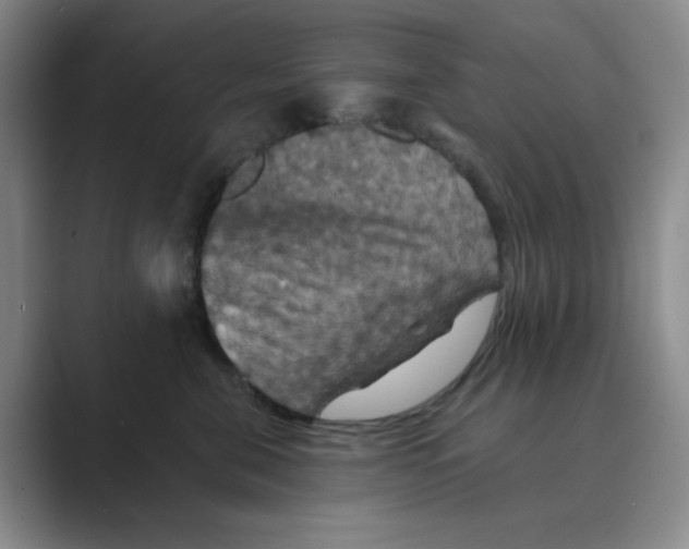 X0000088690571200706282005