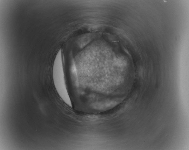 X0000088690914200706281959