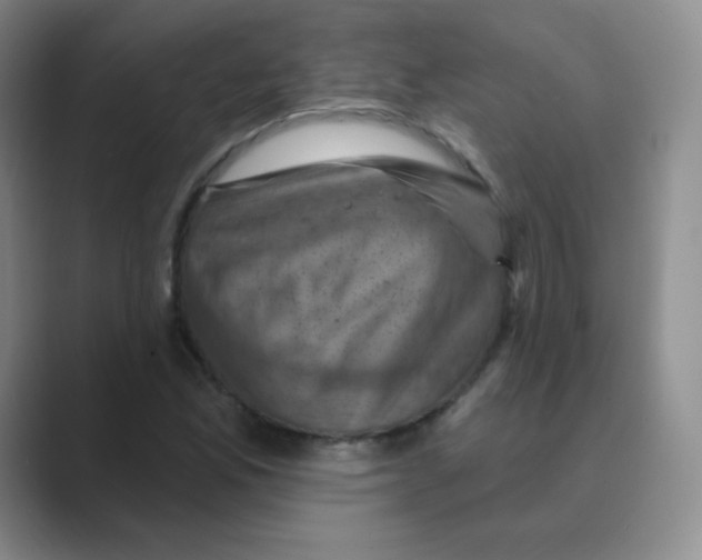 X0000088691165200706281957
