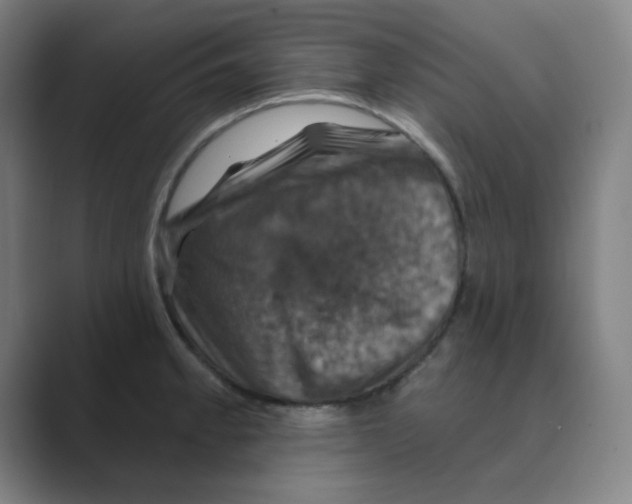 X0000088691189200706281956