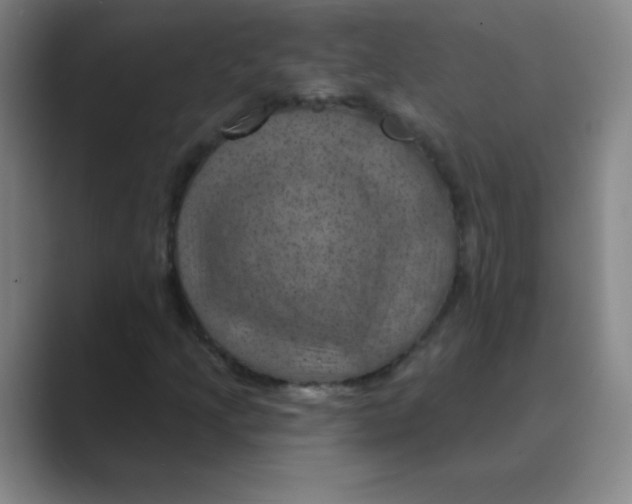 X0000088691205200706281955